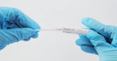 Covid-19 DELTA Varyantı etiketli kan testi.