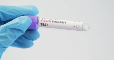 Covid-19 DELTA Varyantı etiketli kan testi.