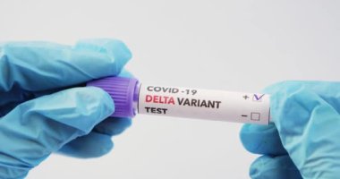 Covid-19 DELTA Varyantı etiketli kan testi.