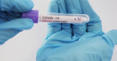 Covid-19 DELTA Varyantı etiketli kan testi.