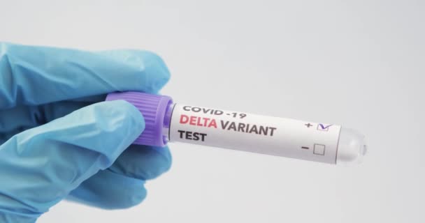 혈액 검사 라벨 Covid-19 DELTA Variant. — 비디오