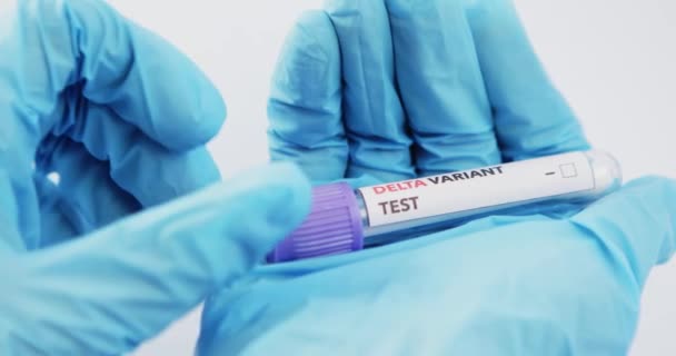 Аналіз крові на етикетці Covid-19 DELTA Варіації. — стокове відео
