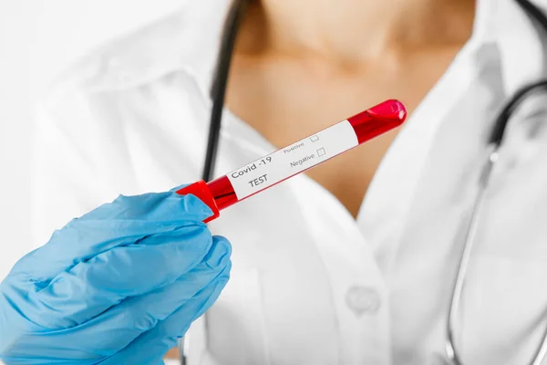 Krevní test s etiketou Covid-19 DELTA Varianta. — Stock fotografie