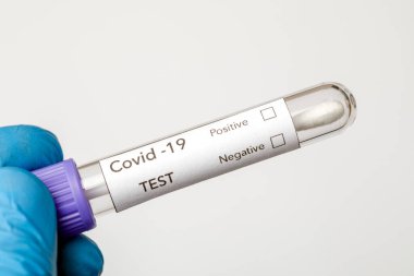 Covid-19 DELTA Varyantı etiketli kan testi.