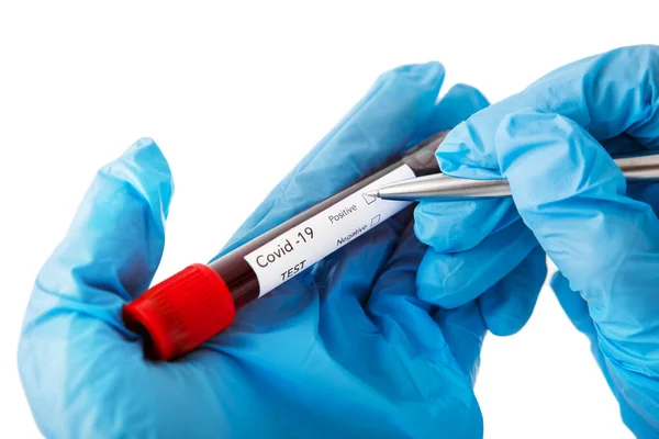 Blood test with the label Covid-19 DELTA Variant — Stock Photo, Image