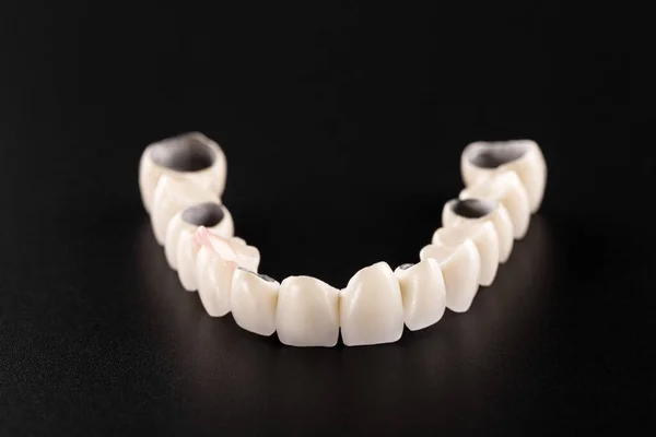 white ceramic teeth isolated on black background. ceramic dental veneers for the upper jaw