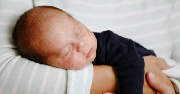 皮膚炎からにきびやにきびと赤ちゃんの顔の皮膚の閉鎖 新生児の衛生 健康とスキンケアの概念 — ストック動画