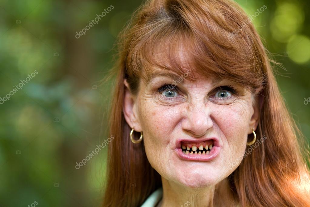 Ugly Woman With Big Teeth