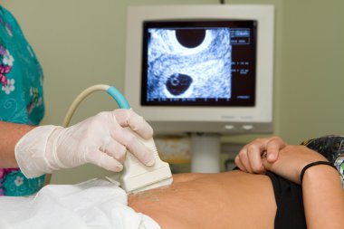 Pregnancy Ultrasound clipart