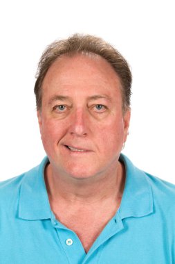 Bells palsy mans