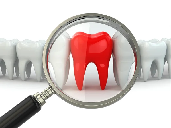 Search aching tooth in row of healthy teeth. — Stock Photo, Image