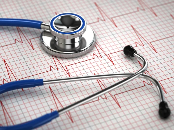 Sztetoszkóp és EKG cardiogram. gyógyszer fogalma, — Stock Fotó