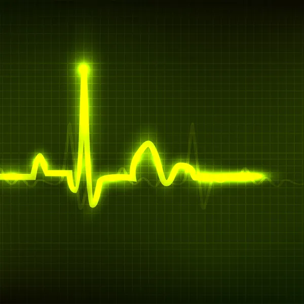 Cardiogram achtergrond. EPS 10. — Stockvector