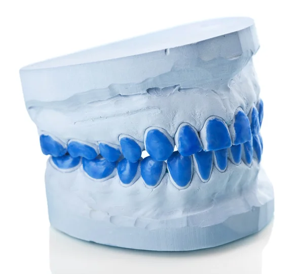 Индивидуальные гипсовые стоматологические формы для изготовления подносов — стоковое фото