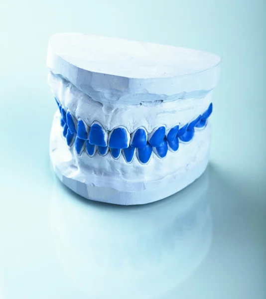 Δοκιμασίας· γύψο οδοντικές φόρμες για να κάνει τους δίσκους — Φωτογραφία Αρχείου