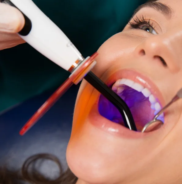 Młoda kobieta przerwanie leczenia za pomocą sprzętu dentystycznego Uv Light — Zdjęcie stockowe