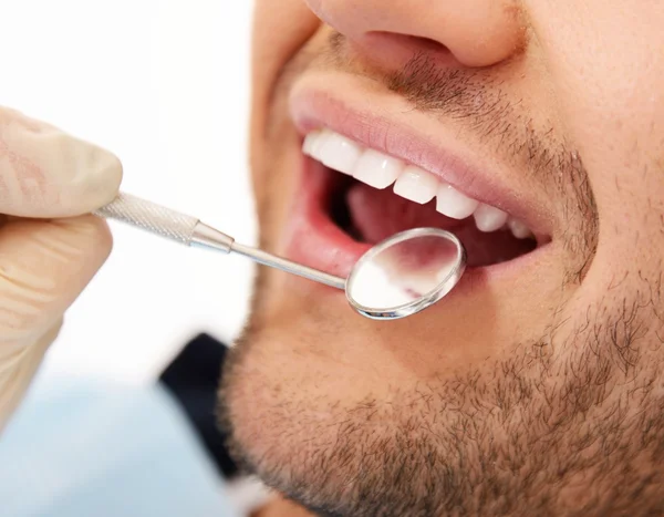 Hombre haciendo chequeo dental en la cirugía del dentista —  Fotos de Stock