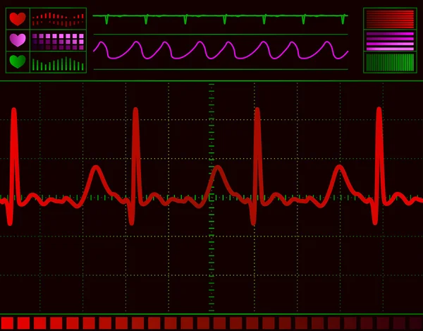 Pantalla del monitor del corazón — Vector de stock