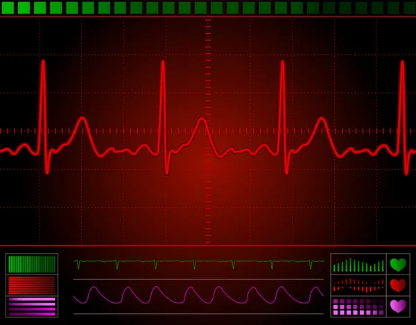 Herzmonitor — Stockvektor