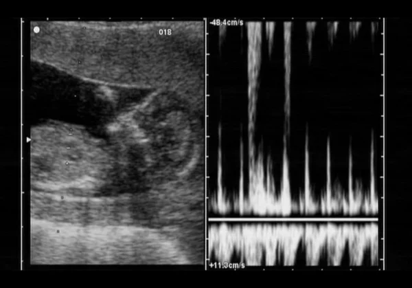 超音波胎児 — ストック写真
