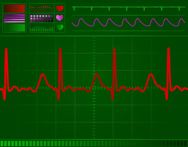 Серце екрану монітора — стоковий вектор