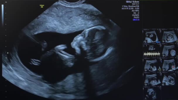USG kobiety w ciąży — Wideo stockowe
