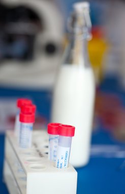 test tüpleri