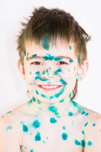 Fröhlicher kranker Junge auf weißem Hintergrund — Stockfoto