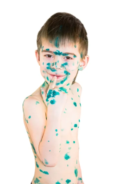 Feliz menino doente em um fundo branco — Fotografia de Stock