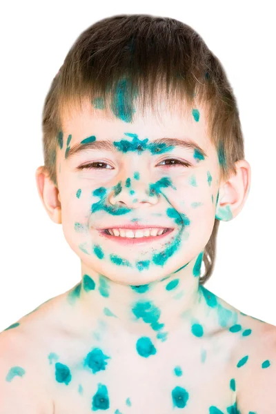 Feliz menino doente em um fundo branco — Fotografia de Stock