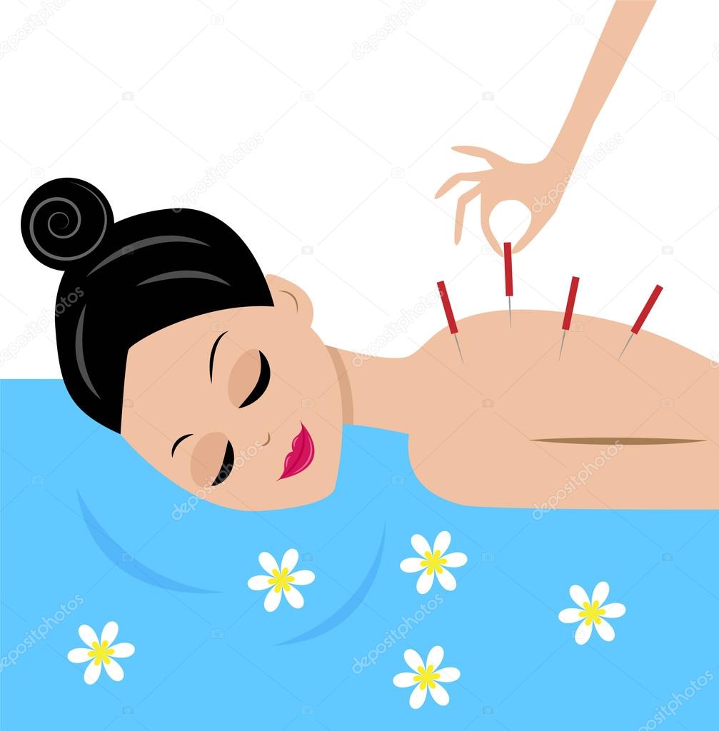 Young woman accept procedure acupuncture Stock Illustration by