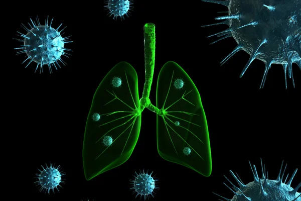 Infection virale dans les poumons — Photo