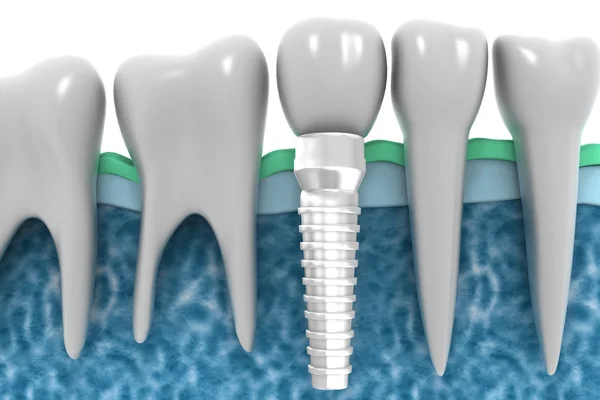 Dentes isolados em fundo branco — Fotografia de Stock