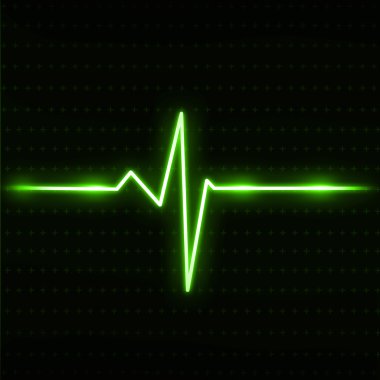 EKG Elektrokardiyogram