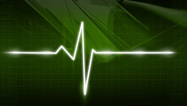 EKG-Elektrokardiogramm — Stockfoto