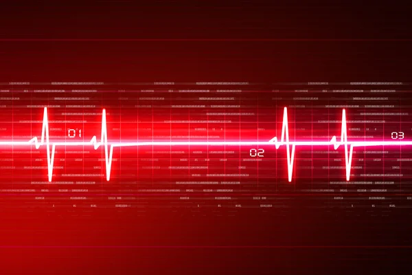 Elektrokardiogram EKG — Zdjęcie stockowe