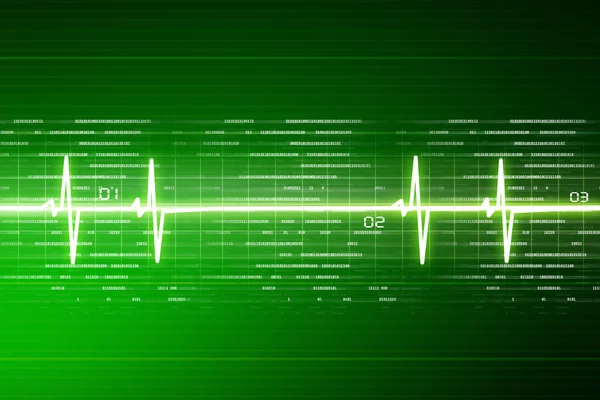 EKG-Elektrokardiogramm — Stockfoto