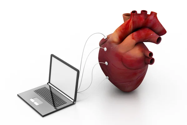 Υπολογιστής συνδεδεμένος με μια ανθρώπινη καρδιά — Φωτογραφία Αρχείου