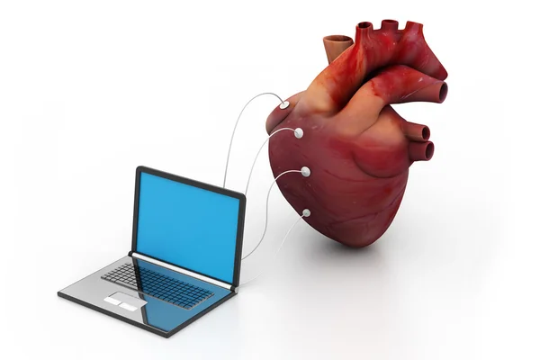Computador ligado a um coração humano — Fotografia de Stock