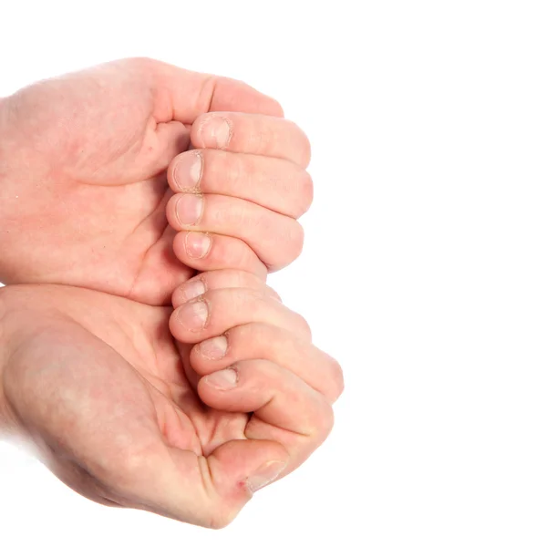 Руки грызущих ногти — стоковое фото