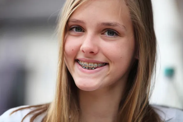 Jonge tiener meisje met orthodontische beugel — Stockfoto