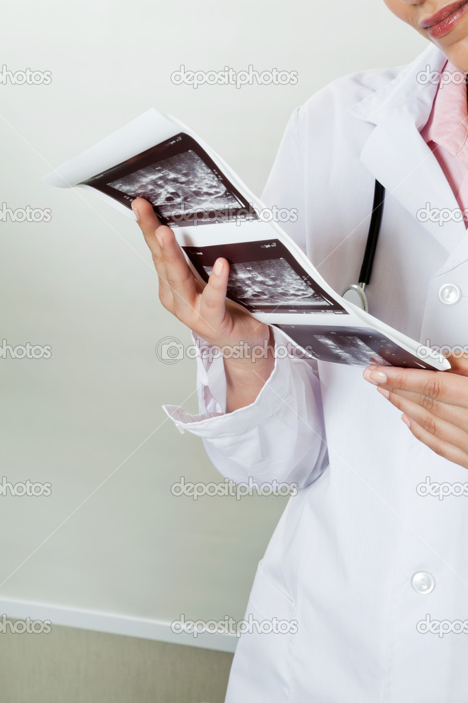 Radiologist Holding Ultrasound Print