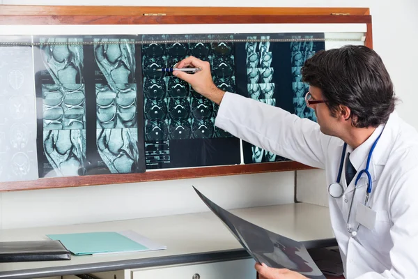 Radiologe begutachtet Röntgenbild in Klinik — Stockfoto