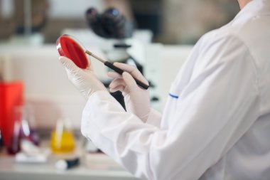 petri kabına kan örneği ile inceleyen bilim