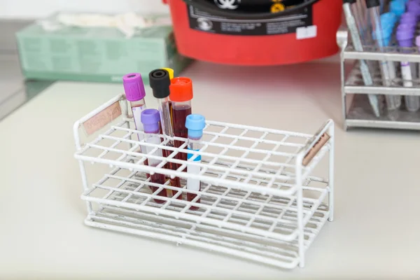 Test Tubes With Blood Samples — Stock Photo, Image