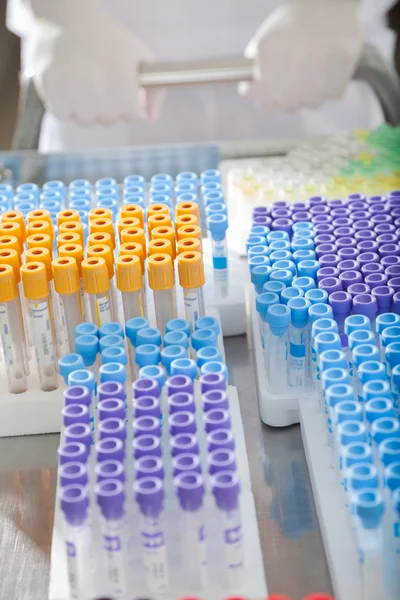 Test Tubes On Medical Trolley — Stock Photo, Image