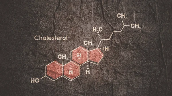 Strukturální chemický vzorec cholesterolu. Infografická ilustrace. — Stock fotografie
