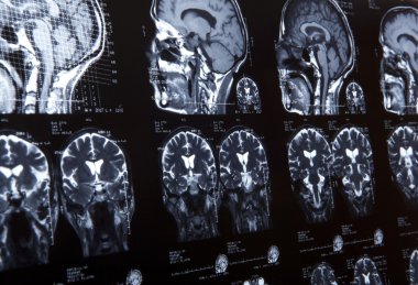 MRI of human brain clipart