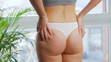 Kalçasına baskı yapan kadın selülit ve deri altı yağlarını kontrol ediyor.