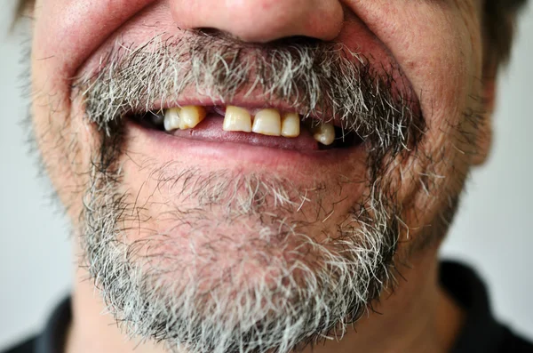 Cara do homem com um sorriso sem dentes — Fotografia de Stock